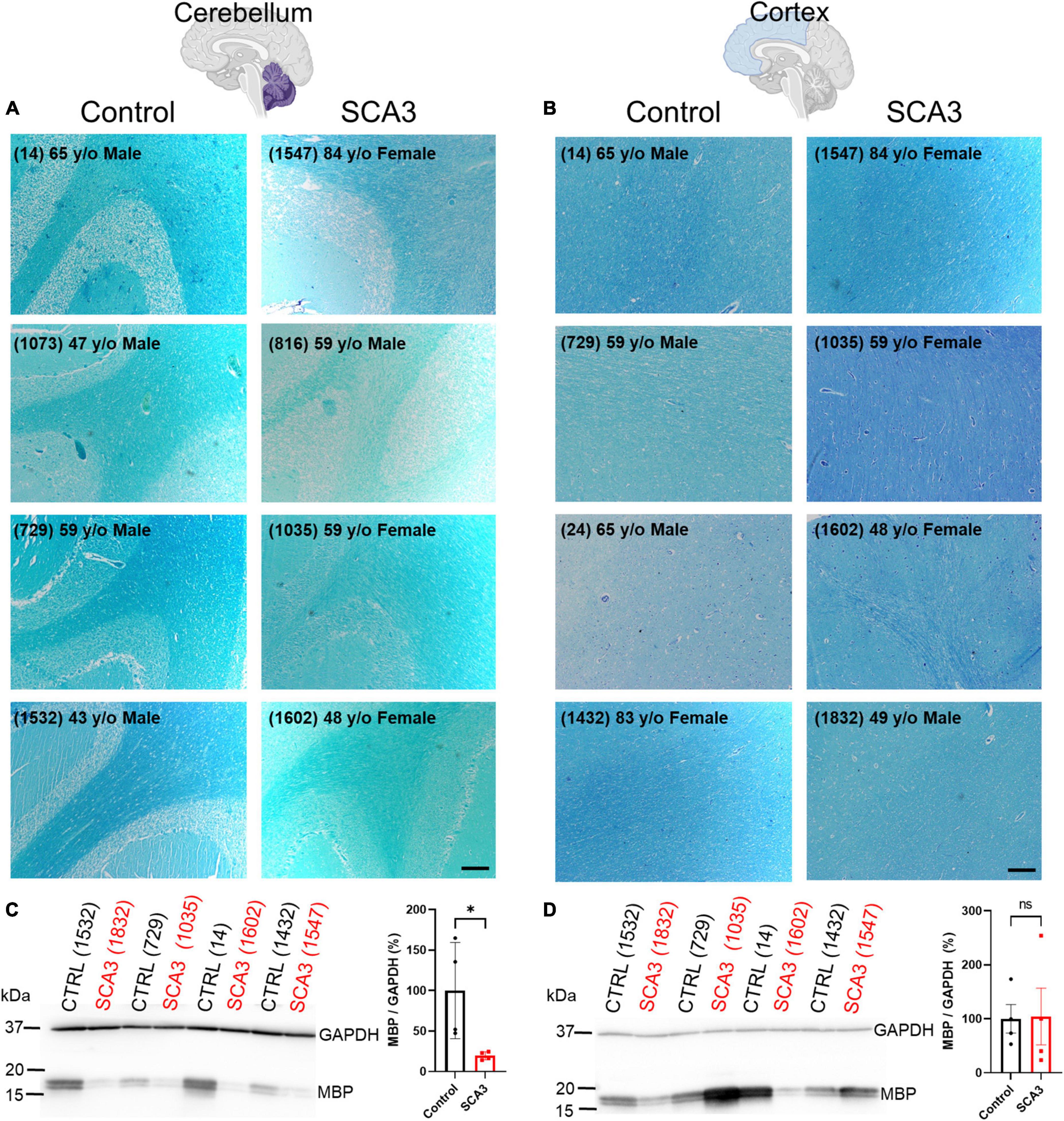 Disease-associated oligodendrocyte signatures are spatiotemporally dysregulated in spinocerebellar ataxia type 3